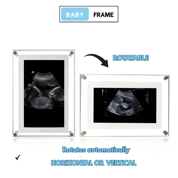 Baby Frame ™ Digital Frame