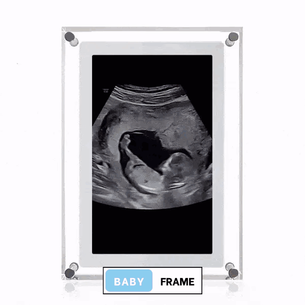 Baby Frame ™ Digital Frame